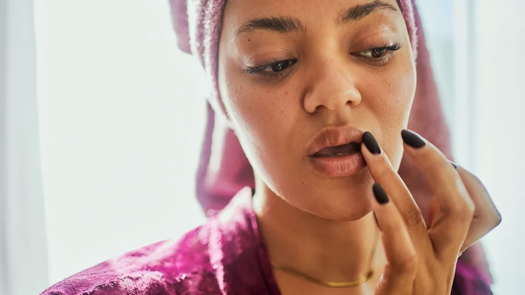 dr.consulta - Pessoa com herpes labial com bolhas nos lábios em fase de cicatrização