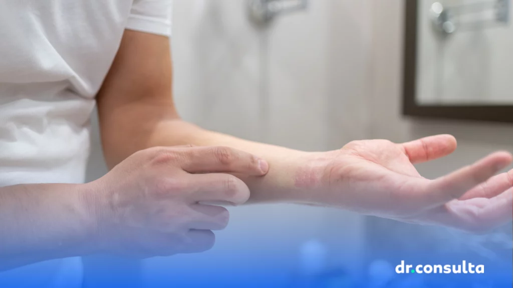 Os diferentes tipos de dermatite e como se manifestam na pele