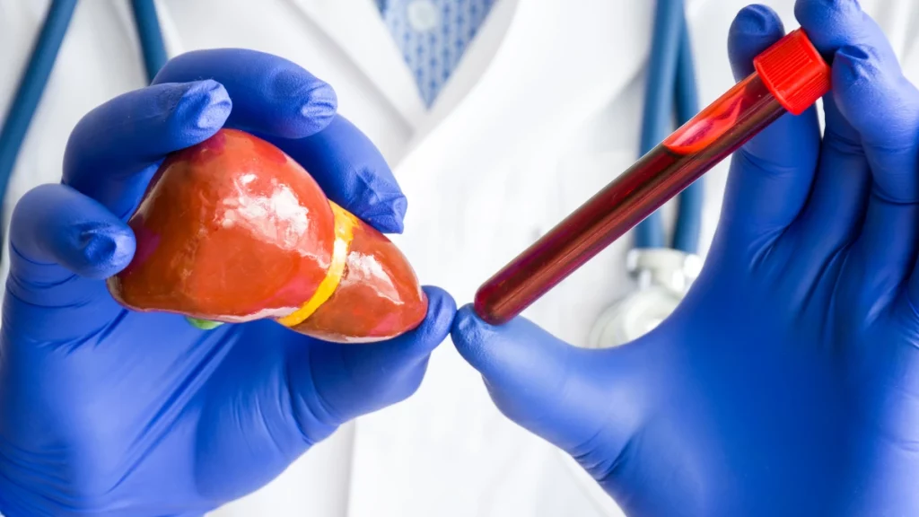 dr.consulta - Na imagem, profissional de saúde segura molde de fígado e tubo de ensaio com sangue. O exame de sangue para dosagem de bilirrubina é feite para investigar casos de pele e olhos amarelos.