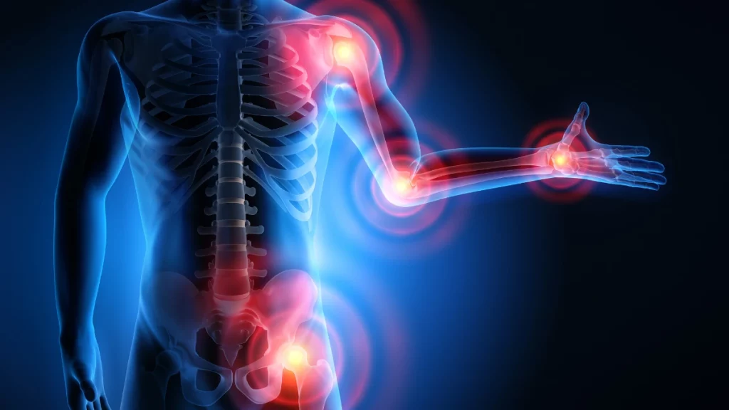 dr.consulta - Ilustração 3D de corpo humano no qual as principais juntas (punhos, cotovelos, ombros e quadris) mostram as áreas acometidas pelo reumatismo.