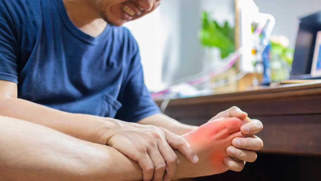 dr.consulta - Homem segurando o pé com crise de gota, um tipo de reumatismo.