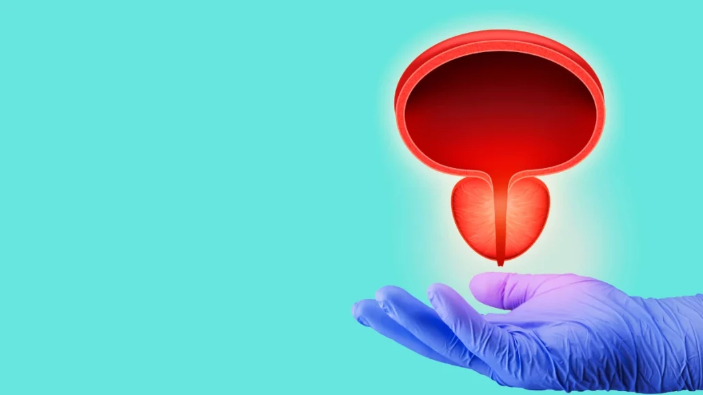 Aumento da próstata: câncer, inflamação e outras causas