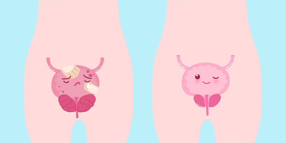 Hiperplasia da próstata é mais comum do que aparenta