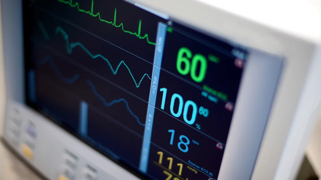 dr.consulta - batimentos cardíacos sendo exibidos em um monitor, acompanhamento médico, monitor holter, exame holter, exame para avaliação dos batimentos cardíacos e da saúde do coração