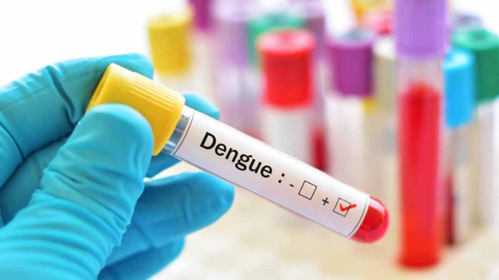 dr.consulta - exame para diagnóstico de dengue