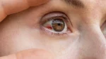 dr.consulta - Na imagem, vasos rompidos em globo ocular simbolizam quadro de derrame no olho.