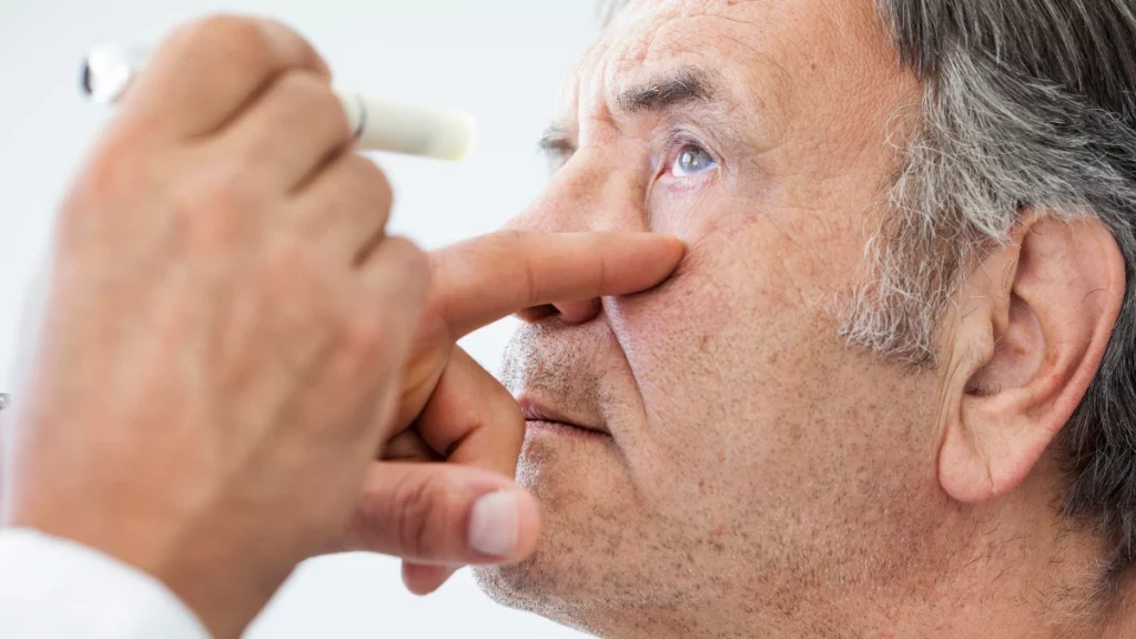 A relação entre glaucoma e catarata