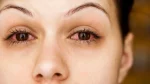 dr.consulta - Na imagem, par de olhos vermelhos causados por conjuntivite.