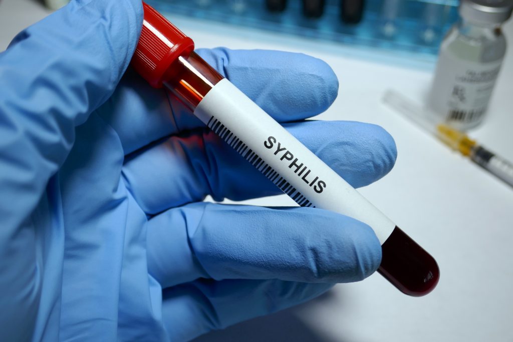 Sífilis: causas, sintomas e tratamento
