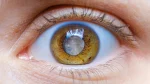 dr.consulta - Na imagem, olho humano com cristalino opaco por catarata.
