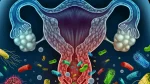 dr.consulta - NA ilustração, conjunto de microrganismos invadem sistema reprodutor feminino, simbolizando quadro de vaginose bacteriana.