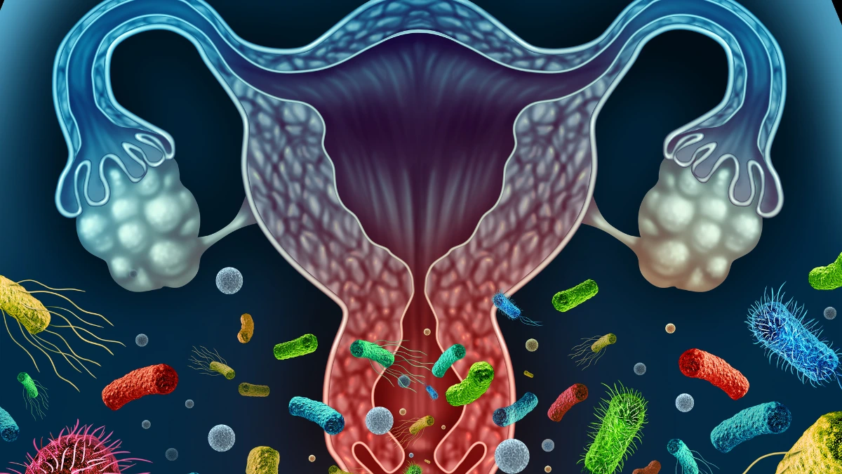 dr.consulta - NA ilustração, conjunto de microrganismos invadem sistema reprodutor feminino, simbolizando quadro de vaginose bacteriana.