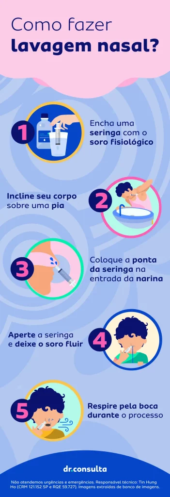 Infográfico ilustrativo ensinando a fazer a lavagem nasal corretamente por meio de 5 passos.