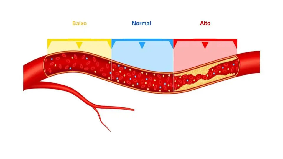 A imagem apresenta uma artéria com exemplos da concentração de colesterol, de acordo com os níveis considerados baixos, normais e altos.