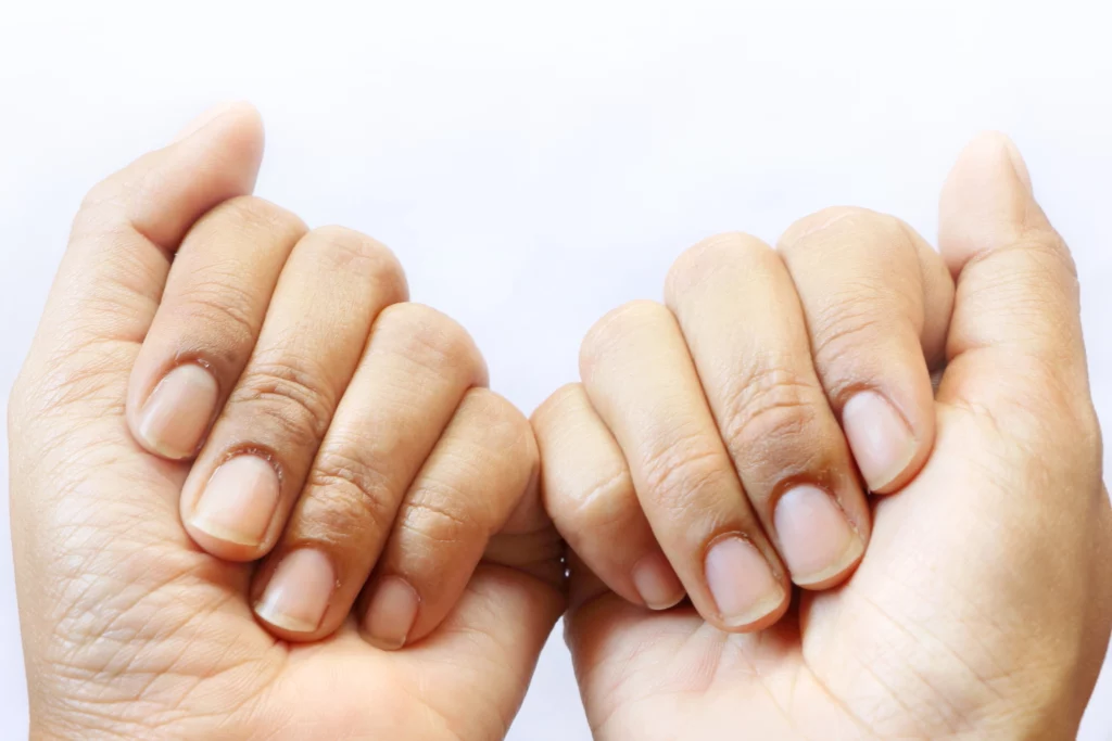 Imagem de duas mãos e suas unhas.