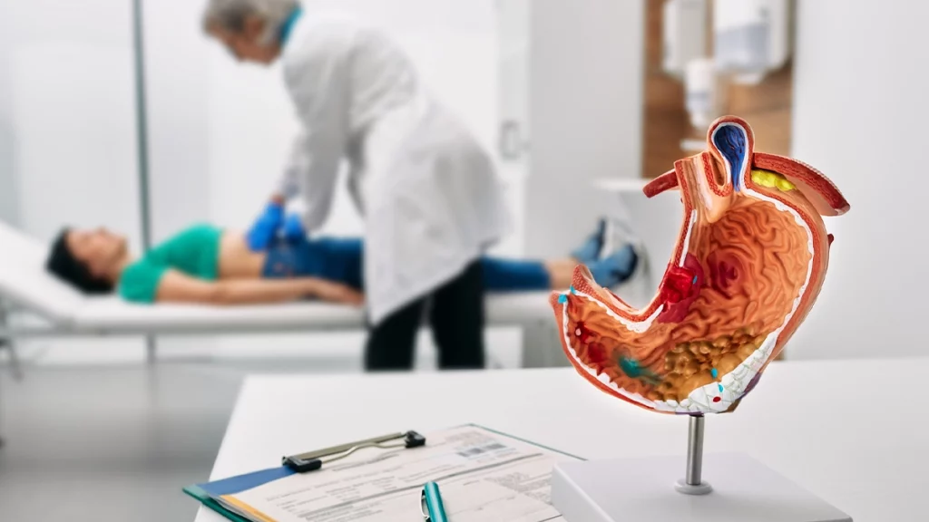 dr.consulta - Modelo anatômico do estômago em consultório médico, ilustrando exame relacionado à gastrite nervosa. 
