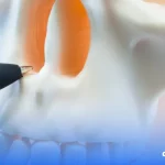 Imagem de um profissional da saúde avaliando as fossas nasais de um esqueleto de demonstração.