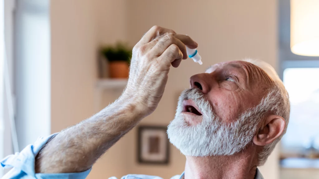 dr.consulta - cirurgia de catarata, homem branco de meia idade com barba pingando colírio no olho, pós cirurgia, cuidados pós-cirurgia, recuperação