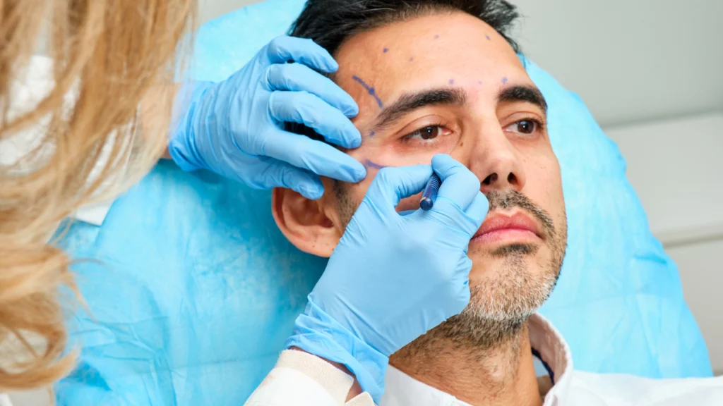 dr.consulta - cirurgiã plástica fazendo as marcações no rosto de um homem que passará por uma cirurgia estética, quando procurar um cirurgião plástico