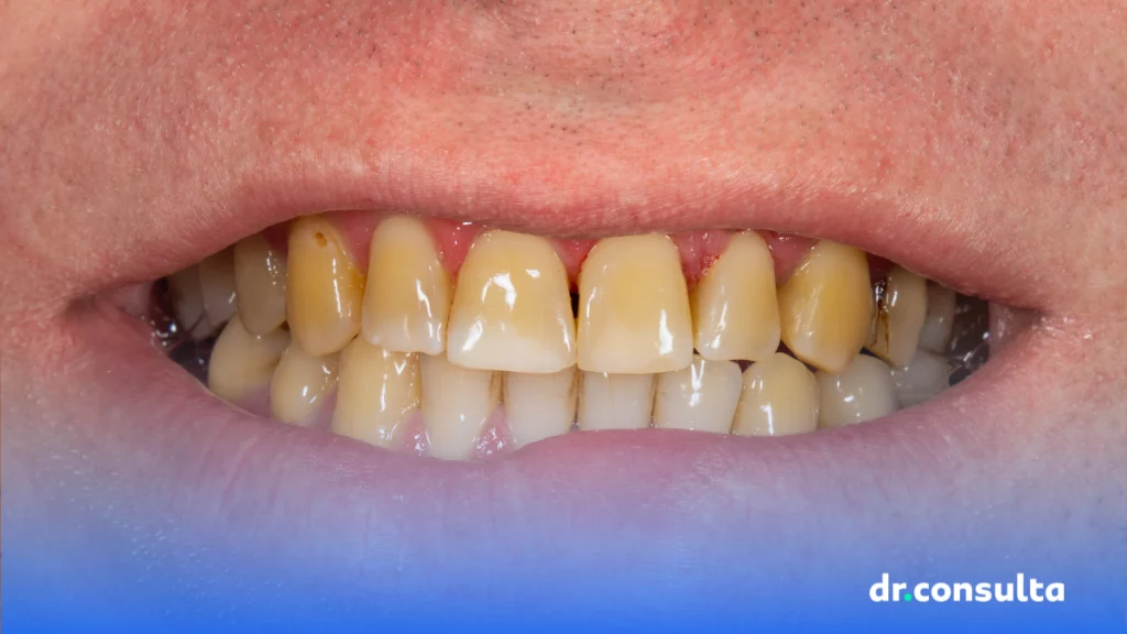 5 dicas para evitar dentes amarelados e ter um sorriso saudável