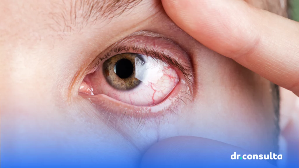 7 possíveis causas para a dor atrás dos olhos