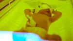 dr.consulta - Na imagem, bebê com quadro de icterícia em recém-nascido em câmara de fototerapia.