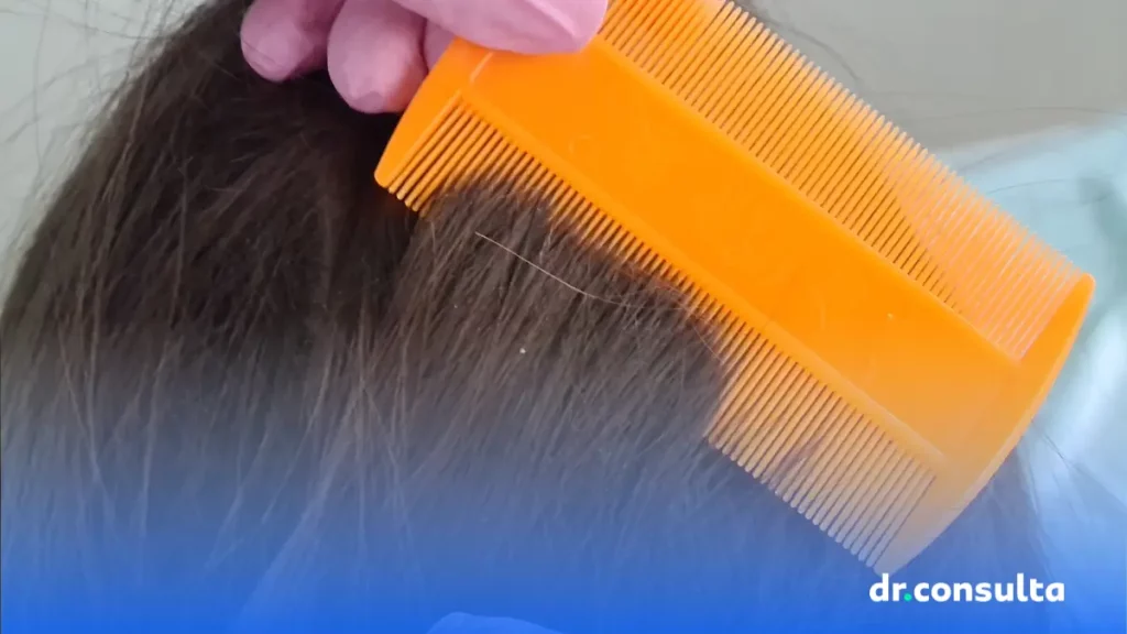 dr.consulta - pessoa passando pente fino no cabelo para o tratamento de piolhos, piolho, lêndeas