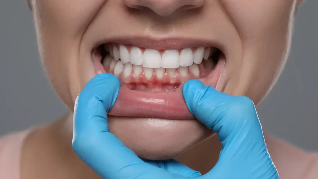 dr.consulta - dentista avaliando os dentes de uma paciente com dor, acompanhamento odontológico, o que é bom para dor de dente