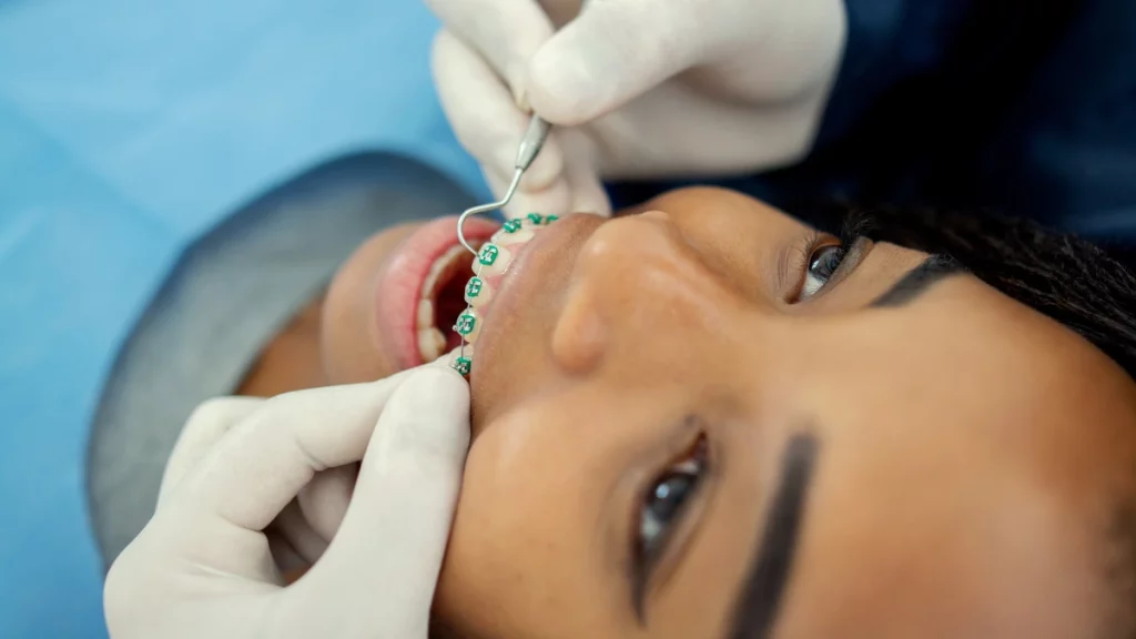 dr.consulta - mulher com aparelho ortodôntico em consultório de dentista, tratamento odontológico