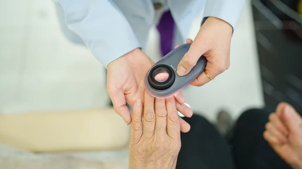 dr.consulta - profissional de saúde avaliando as unhas de uma paciente com micose nas unhas, tratamento, cuidados das mãos e dos pés