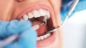 Entenda como um abscesso dentário surge na boca