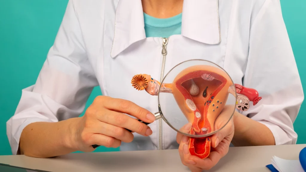 Saiba mais sobre a candidíase vulvovaginal