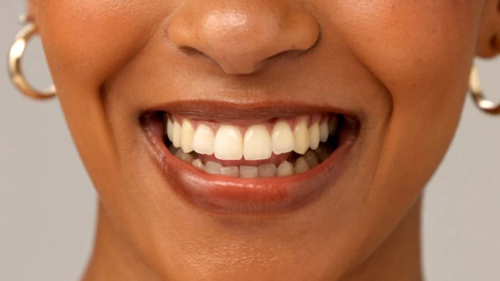 dr.consulta - Mulher sorrindo com dentes bonitos pelo uso de flúor.