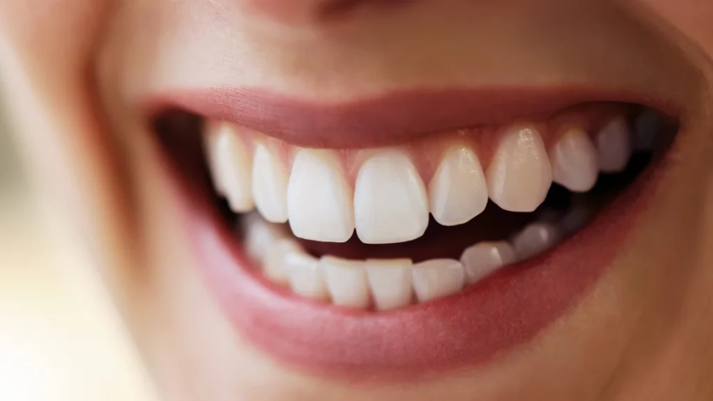 dr.consulta - Imagem de sorriso bonito com prótese parcial removível.