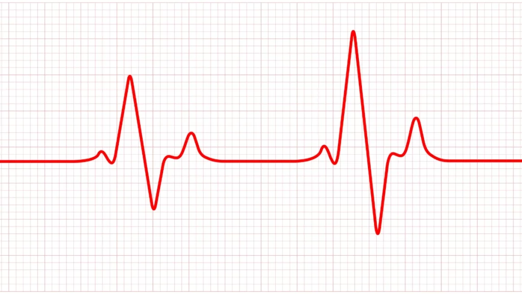 dr.consulta - Na ilustração, batimento cardíaco simbolizando quadro de bradicardia.