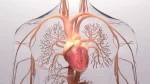 dr.consulta - Na ilustração 3D, detalhes da anatomia do coração com pericardite.