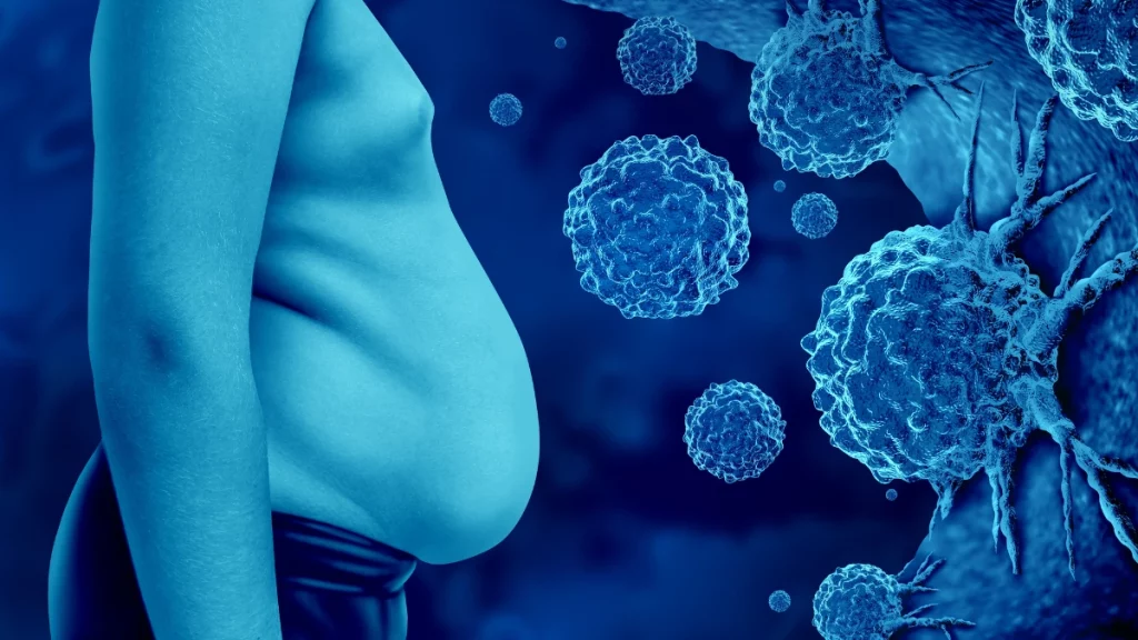 dr.consulta - Imagem de pessoa obesa e células cancerígenas. O câncer é uma das doenças causadas pela obesidade.