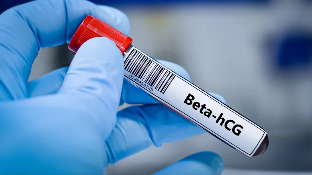 Entenda o que o exame de beta hCG quantitativo calcula