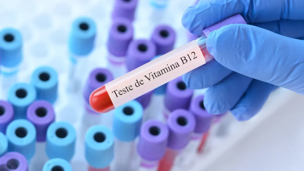 Saiba em que situações o exame de vitamina B12 é indicado