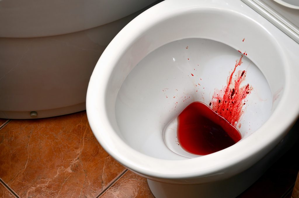 É perigoso sangue na urina feminina? Confira as causas