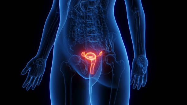 Câncer do colo do útero: sintomas, causas e prevenção