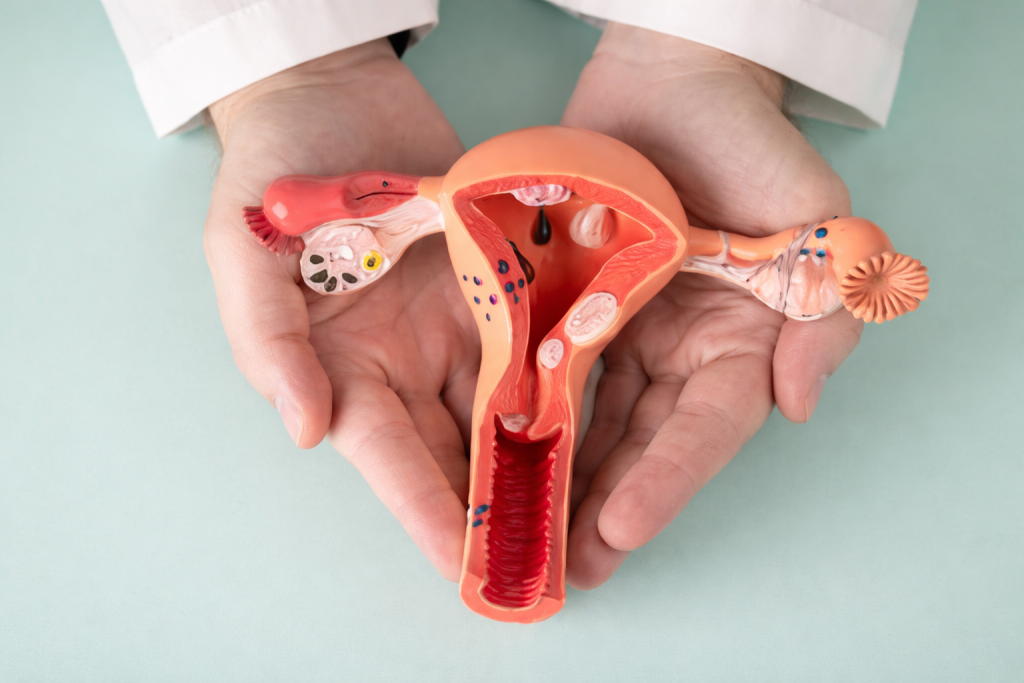 Endometriose: o que é, sintomas, tratamento e quando a cólica deixa de ser normal